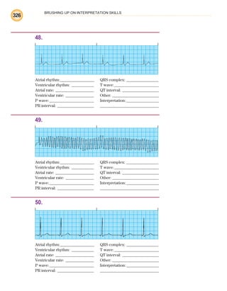 BRUSHING UP ON INTERPRETATION SKILLS
326
48.
Atrial rhythm:________________ QRS complex: _______________
Ventricular rhythm: ___________ T wave:______________________
Atrial rate: ___________________ QT interval: __________________
Ventricular rate: ______________ Other: _______________________
P wave:______________________ Interpretation:________________
PR interval: __________________ _____________________________
49.
Atrial rhythm:________________ QRS complex: _______________
Ventricular rhythm: ___________ T wave:______________________
Atrial rate: ___________________ QT interval: __________________
Ventricular rate: ______________ Other: _______________________
P wave:______________________ Interpretation:________________
PR interval: __________________ _____________________________
50.
Atrial rhythm:________________ QRS complex: _______________
Ventricular rhythm: ___________ T wave:______________________
Atrial rate: ___________________ QT interval: __________________
Ventricular rate: ______________ Other: _______________________
P wave:______________________ Interpretation:________________
PR interval: __________________ _____________________________
ECG_BM.indd 326
ECG_BM.indd 326 7/7/2010 5:46:29 PM
7/7/2010 5:46:29 PM
 