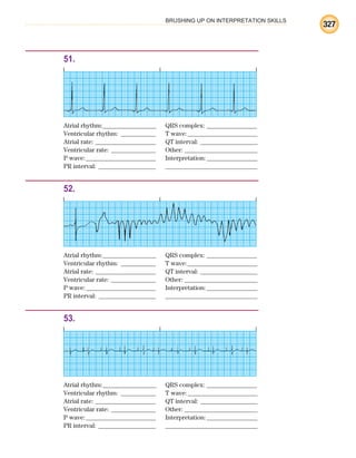 BRUSHING UP ON INTERPRETATION SKILLS
327
51.
Atrial rhythm:________________ QRS complex: _______________
Ventricular rhythm: ___________ T wave:______________________
Atrial rate: ___________________ QT interval: __________________
Ventricular rate: ______________ Other: _______________________
P wave:______________________ Interpretation:________________
PR interval: __________________ _____________________________
52.
Atrial rhythm:________________ QRS complex: _______________
Ventricular rhythm: ___________ T wave:______________________
Atrial rate: ___________________ QT interval: __________________
Ventricular rate: ______________ Other: _______________________
P wave:______________________ Interpretation:________________
PR interval: __________________ _____________________________
53.
Atrial rhythm:________________ QRS complex: _______________
Ventricular rhythm: ___________ T wave:______________________
Atrial rate: ___________________ QT interval: __________________
Ventricular rate: ______________ Other: _______________________
P wave:______________________ Interpretation:________________
PR interval: __________________ _____________________________
ECG_BM.indd 327
ECG_BM.indd 327 7/7/2010 5:46:30 PM
7/7/2010 5:46:30 PM
 