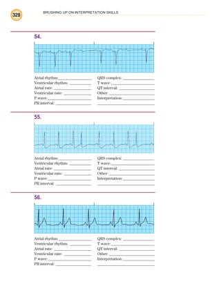 BRUSHING UP ON INTERPRETATION SKILLS
328
54.
Atrial rhythm:________________ QRS complex: _______________
Ventricular rhythm: ___________ T wave:______________________
Atrial rate: ___________________ QT interval: __________________
Ventricular rate: ______________ Other: _______________________
P wave:______________________ Interpretation:________________
PR interval: __________________ _____________________________
55.
Atrial rhythm:________________ QRS complex: _______________
Ventricular rhythm: ___________ T wave:______________________
Atrial rate: ___________________ QT interval: __________________
Ventricular rate: ______________ Other: _______________________
P wave:______________________ Interpretation:________________
PR interval: __________________ _____________________________
56.
Atrial rhythm:________________ QRS complex: _______________
Ventricular rhythm: ___________ T wave:______________________
Atrial rate: ___________________ QT interval: __________________
Ventricular rate: ______________ Other: _______________________
P wave:______________________ Interpretation:________________
PR interval: __________________ _____________________________
ECG_BM.indd 328
ECG_BM.indd 328 7/7/2010 5:46:30 PM
7/7/2010 5:46:30 PM
 