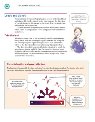 24
OBTAINING A RHYTHM STRIP
Leads and planes
To understand electrocardiography, you need to understand leads
and planes. Electrodes placed on the skin measure the direction
of electrical current discharged by the heart. That current is then
transformed into waveforms.
An ECG records information about those waveforms from dif-
ferent views or perspectives. Those perspectives are called leads
and planes.
Take the lead
A lead provides a view of the heart’s electrical activity between
one positive pole and one negative pole. Between the two poles
lies an imaginary line representing the lead’s axis, a term that
refers to the direction of the current moving through the heart.
The direction of the current affects the direction in which the
waveform points on an ECG. (See Current direction and wave
deflection.) When no electrical activity occurs or the activity is too
weak to measure, the waveform looks like a straight line, called
an isoelectric waveform.
Leads and planes
offer different views of
the heart’s electrical
activity.
Current direction and wave deflection
This illustration shows possible directions of electrical current, or depolarization, on a lead. The direction of the electri-
cal current determines the upward or downward deflection of an electrocardiogram waveform.
When current
flows perpendicular to
the lead, the waveform
may be small or go in
both directions
(biphasic).
As current
travels toward the
positive pole, the
waveform deflects
mostly upward.
As current travels
toward the negative pole,
the waveform deflects
mostly downward.
ECG_Chap02.indd 24
ECG_Chap02.indd 24 7/8/2010 4:16:42 PM
7/8/2010 4:16:42 PM
 