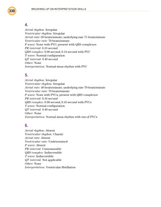 BRUSHING UP ON INTERPRETATION SKILLS
330
4.
Atrial rhythm: Irregular
Ventricular rhythm: Irregular
Atrial rate: 60 beats/minute; underlying rate 71 beats/minute
Ventricular rate: 70 beats/minute
P wave: None with PVC; present with QRS complexes
PR interval: 0.16 second
QRS complex: 0.08 second; 0.14 second with PVC
T wave: Normal configuration
QT interval: 0.40 second
Other: None
Interpretation: Normal sinus rhythm with PVC
5.
Atrial rhythm: Irregular
Ventricular rhythm: Irregular
Atrial rate: 40 beats/minute; underlying rate 70 beats/minute
Ventricular rate: 70 beats/minute
P wave: None with PVCs; present with QRS complexes
PR interval: 0.16 second
QRS complex: 0.08 second; 0.16 second with PVCs
T wave: Normal configuration
QT interval: 0.40 second
Other: None
Interpretation: Normal sinus rhythm with run of PVCs
6.
Atrial rhythm: Absent
Ventricular rhythm: Chaotic
Atrial rate: Absent
Ventricular rate: Undetermined
P wave: Absent
PR interval: Unmeasurable
QRS complex: Indiscernible
T wave: Indiscernible
QT interval: Not applicable
Other: None
Interpretation: Ventricular fibrillation
ECG_BM.indd 330
ECG_BM.indd 330 7/7/2010 5:46:31 PM
7/7/2010 5:46:31 PM
 