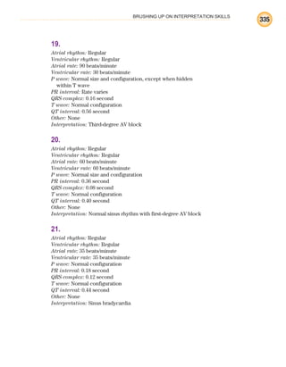 BRUSHING UP ON INTERPRETATION SKILLS
335
19.
Atrial rhythm: Regular
Ventricular rhythm: Regular
Atrial rate: 90 beats/minute
Ventricular rate: 30 beats/minute
P wave: Normal size and configuration, except when hidden
within T wave
PR interval: Rate varies
QRS complex: 0.16 second
T wave: Normal configuration
QT interval: 0.56 second
Other: None
Interpretation: Third-degree AV block
20.
Atrial rhythm: Regular
Ventricular rhythm: Regular
Atrial rate: 60 beats/minute
Ventricular rate: 60 beats/minute
P wave: Normal size and configuration
PR interval: 0.36 second
QRS complex: 0.08 second
T wave: Normal configuration
QT interval: 0.40 second
Other: None
Interpretation: Normal sinus rhythm with first-degree AV block
21.
Atrial rhythm: Regular
Ventricular rhythm: Regular
Atrial rate: 35 beats/minute
Ventricular rate: 35 beats/minute
P wave: Normal configuration
PR interval: 0.18 second
QRS complex: 0.12 second
T wave: Normal configuration
QT interval: 0.44 second
Other: None
Interpretation: Sinus bradycardia
ECG_BM.indd 335
ECG_BM.indd 335 7/7/2010 5:46:31 PM
7/7/2010 5:46:31 PM
 