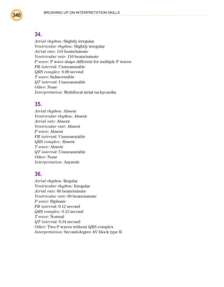 BRUSHING UP ON INTERPRETATION SKILLS
340
34.
Atrial rhythm: Slightly irregular
Ventricular rhythm: Slightly irregular
Atrial rate: 110 beats/minute
Ventricular rate: 110 beats/minute
P wave: P wave shape different for multiple P waves
PR interval: Unmeasurable
QRS complex: 0.08 second
T wave: Indiscernible
QT interval: Unmeasurable
Other: None
Interpretation: Multifocal atrial tachycardia
35.
Atrial rhythm: Absent
Ventricular rhythm: Absent
Atrial rate: Absent
Ventricular rate: Absent
P wave: Absent
PR interval: Unmeasurable
QRS complex: Absent
T wave: Absent
QT interval: Unmeasurable
Other: None
Interpretation: Asystole
36.
Atrial rhythm: Regular
Ventricular rhythm: Irregular
Atrial rate: 80 beats/minute
Ventricular rate: 60 beats/minute
P wave: Biphasic
PR interval: 0.12 second
QRS complex: 0.12 second
T wave: Normal
QT interval: 0.34 second
Other: Two P waves without QRS complex
Interpretation: Second-degree AV block type II
ECG_BM.indd 340
ECG_BM.indd 340 7/7/2010 5:46:32 PM
7/7/2010 5:46:32 PM
 
