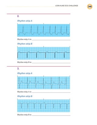LOOK-ALIKE ECG CHALLENGE
349
2.
Rhythm strip A
Rhythm strip A is:
1.Rhythm strip B
Rhythm strip B is:
3.
Rhythm strip A
Rhythm strip A is:
1.Rhythm strip B
Rhythm strip B is:
ECG_BM.indd 349
ECG_BM.indd 349 7/7/2010 5:46:33 PM
7/7/2010 5:46:33 PM
 