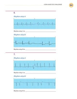 LOOK-ALIKE ECG CHALLENGE
351
6.
Rhythm strip A
Rhythm strip A is:
1.Rhythm strip B
Rhythm strip B is:
7.
Rhythm strip A
Rhythm strip A is:
1.Rhythm strip B
Rhythm strip B is:
ECG_BM.indd 351
ECG_BM.indd 351 7/7/2010 5:46:35 PM
7/7/2010 5:46:35 PM
 