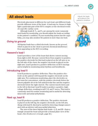 27
ALL ABOUT LEADS
All about leads
Electrode placement is different for each lead, and different leads
provide different views of the heart. A lead may be chosen to high-
light a particular part of the ECG complex or the electrical events
of a specific cardiac cycle.
Although leads II, V1, and V6 are among the most commonly
used leads for monitoring, you should adjust the leads according
to the patient’s condition. If your monitoring system has the capa-
bility, you may also monitor the patient in more than one lead.
Going to ground
All bipolar leads have a third electrode, known as the ground,
which is placed on the chest to prevent electrical interference
from appearing on the ECG recording.
Heeeere’s lead I
Lead I provides a view of the heart that shows current moving
from right to left. Because current flows from negative to positive,
the positive electrode for this lead is placed on the left arm or on
the left side of the chest; the negative electrode is placed on the
right arm. Lead I produces a positive deflection on ECG tracings
and is helpful in monitoring atrial rhythms and hemiblocks.
Introducing lead II
Lead II produces a positive deflection. Place the positive elec-
trode on the patient’s left leg and the negative electrode on the
right arm. For continuous monitoring, place the electrodes on
the torso for convenience, with the positive electrode below the
lowest palpable rib at the left midclavicular line and the negative
electrode below the right clavicle. The current travels down and
to the left in this lead. Lead II tends to produce a positive, high-
voltage deflection, resulting in tall P, R, and T waves. This lead is
commonly used for routine monitoring and is useful for detecting
sinus node and atrial arrhythmias.
Next up, lead III
Lead III produces a positive deflection. The positive electrode
is placed on the left leg; the negative electrode, on the left arm.
Along with lead II, this lead is useful for detecting changes associ-
ated with an inferior wall myocardial infarction.
The axes of the three bipolar limb leads—I, II, and III—form a
triangle around the heart and provide a frontal plane view of the
heart. (See Einthoven’s triangle, page 28.)
Adjust the leads
according to the
patient’s condition.
ECG_Chap02.indd 27
ECG_Chap02.indd 27 7/8/2010 4:16:44 PM
7/8/2010 4:16:44 PM
 