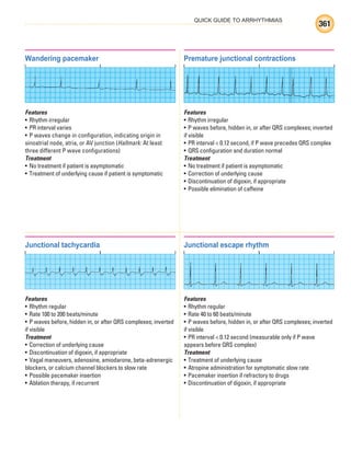 QUICK GUIDE TO ARRHYTHMIAS
361
Wandering pacemaker
Features
• Rhythm irregular
• PR interval varies
• P waves change in configuration, indicating origin in
sinoatrial node, atria, or AV junction (Hallmark: At least
three different P wave configurations)
Treatment
• No treatment if patient is asymptomatic
• Treatment of underlying cause if patient is symptomatic
Premature junctional contractions
Features
• Rhythm irregular
• P waves before, hidden in, or after QRS complexes; inverted
if visible
• PR interval  0.12 second, if P wave precedes QRS complex
• QRS configuration and duration normal
Treatment
• No treatment if patient is asymptomatic
• Correction of underlying cause
• Discontinuation of digoxin, if appropriate
• Possible elimination of caffeine
Junctional tachycardia
Features
• Rhythm regular
• Rate 100 to 200 beats/minute
• P waves before, hidden in, or after QRS complexes; inverted
if visible
Treatment
• Correction of underlying cause
• Discontinuation of digoxin, if appropriate
• Vagal maneuvers, adenosine, amiodarone, beta-adrenergic
blockers, or calcium channel blockers to slow rate
• Possible pacemaker insertion
• Ablation therapy, if recurrent
Junctional escape rhythm
Features
• Rhythm regular
• Rate 40 to 60 beats/minute
• P waves before, hidden in, or after QRS complexes; inverted
if visible
• PR interval  0.12 second (measurable only if P wave
appears before QRS complex)
Treatment
• Treatment of underlying cause
• Atropine administration for symptomatic slow rate
• Pacemaker insertion if refractory to drugs
• Discontinuation of digoxin, if appropriate
ECG_BM.indd 361
ECG_BM.indd 361 7/7/2010 5:46:41 PM
7/7/2010 5:46:41 PM
 