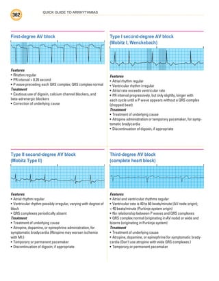 QUICK GUIDE TO ARRHYTHMIAS
362
Type II second-degree AV block
(Mobitz Type II)
Features
• Atrial rhythm regular
• Ventricular rhythm possibly irregular, varying with degree of
block
• QRS complexes periodically absent
Treatment
• Treatment of underlying cause
• Atropine, dopamine, or epinephrine administration, for
symptomatic bradycardia (Atropine may worsen ischemia
with MI.)
• Temporary or permanent pacemaker
• Discontinuation of digoxin, if appropriate
First-degree AV block
Features
• Rhythm regular
• PR interval  0.20 second
• P wave preceding each QRS complex; QRS complex normal
Treatment
• Cautious use of digoxin, calcium channel blockers, and
beta-adrenergic blockers
• Correction of underlying cause
Type I second-degree AV block
(Mobitz I, Wenckebach)
Features
• Atrial rhythm regular
• Ventricular rhythm irregular
• Atrial rate exceeds ventricular rate
• PR interval progressively, but only slightly, longer with
each cycle until a P wave appears without a QRS complex
(dropped beat)
Treatment
• Treatment of underlying cause
• Atropine administration or temporary pacemaker, for symp-
tomatic bradycardia
• Discontinuation of digoxin, if appropriate
Third-degree AV block
(complete heart block)
Features
• Atrial and ventricular rhythms regular
• Ventricular rate is 40 to 60 beats/minute (AV node origin);
 40 beats/minute (Purkinje system origin)
• No relationship between P waves and QRS complexes
• QRS complex normal (originating in AV node) or wide and
bizarre (originating in Purkinje system)
Treatment
• Treatment of underlying cause
• Atropine, dopamine, or epinephrine for symptomatic brady-
cardia (Don’t use atropine with wide QRS complexes.)
• Temporary or permanent pacemaker
ECG_BM.indd 362
ECG_BM.indd 362 7/7/2010 5:46:42 PM
7/7/2010 5:46:42 PM
 