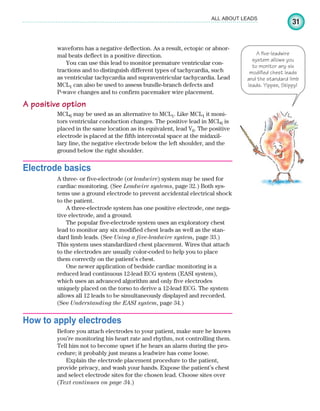 31
ALL ABOUT LEADS
waveform has a negative deflection. As a result, ectopic or abnor-
mal beats deflect in a positive direction.
You can use this lead to monitor premature ventricular con-
tractions and to distinguish different types of tachycardia, such
as ventricular tachycardia and supraventricular tachycardia. Lead
MCL1 can also be used to assess bundle-branch defects and
P-wave changes and to confirm pacemaker wire placement.
A positive option
MCL6 may be used as an alternative to MCL1. Like MCL1 it moni-
tors ventricular conduction changes. The positive lead in MCL6 is
placed in the same location as its equivalent, lead V6. The positive
electrode is placed at the fifth intercostal space at the midaxil-
lary line, the negative electrode below the left shoulder, and the
ground below the right shoulder.
Electrode basics
A three- or five-electrode (or leadwire) system may be used for
cardiac monitoring. (See Leadwire systems, page 32.) Both sys-
tems use a ground electrode to prevent accidental electrical shock
to the patient.
A three-electrode system has one positive electrode, one nega-
tive electrode, and a ground.
The popular five-electrode system uses an exploratory chest
lead to monitor any six modified chest leads as well as the stan-
dard limb leads. (See Using a five-leadwire system, page 33.)
This system uses standardized chest placement. Wires that attach
to the electrodes are usually color-coded to help you to place
them correctly on the patient’s chest.
One newer application of bedside cardiac monitoring is a
reduced lead continuous 12-lead ECG system (EASI system),
which uses an advanced algorithm and only five electrodes
uniquely placed on the torso to derive a 12-lead ECG. The system
allows all 12 leads to be simultaneously displayed and recorded.
(See Understanding the EASI system, page 34.)
How to apply electrodes
Before you attach electrodes to your patient, make sure he knows
you’re monitoring his heart rate and rhythm, not controlling them.
Tell him not to become upset if he hears an alarm during the pro-
cedure; it probably just means a leadwire has come loose.
Explain the electrode placement procedure to the patient,
provide privacy, and wash your hands. Expose the patient’s chest
and select electrode sites for the chosen lead. Choose sites over
A five-leadwire
system allows you
to monitor any six
modified chest leads
and the standard limb
leads. Yippee, Skippy!
(Text continues on page 34.)
ECG_Chap02.indd 31
ECG_Chap02.indd 31 7/8/2010 4:16:51 PM
7/8/2010 4:16:51 PM
 
