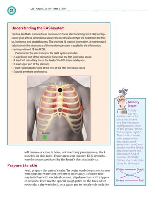 34
OBTAINING A RHYTHM STRIP
soft tissues or close to bone, not over bony prominences, thick
muscles, or skin folds. Those areas can produce ECG artifacts—
waveforms not produced by the heart’s electrical activity.
Prepare the skin
Next, prepare the patient’s skin. To begin, wash the patient’s chest
with soap and water and then dry it thoroughly. Because hair
may interfere with electrical contact, clip dense hair with clippers
or scissors. Then use the special rough patch on the back of the
electrode, a dry washcloth, or a gauze pad to briskly rub each site
Understanding the EASI system
The five-lead EASI (reduced lead continuous 12-lead electrocardiogram [ECG]) configu-
ration gives a three-dimensional view of the electrical activity of the heart from the fron-
tal, horizontal, and sagittal planes. This provides 12 leads of information. A mathematical
calculation in the electronics of the monitoring system is applied to the information,
creating a derived 12-lead ECG.
Placement of the electrodes for the EASI system includes:
E lead:
• lower part of the sternum atthe level of the fifth intercostal space
A lead:
• left midaxillary line at the level of the fifth intercostal space
S lead:
• upperpart of the sternum
I lead:
• right midaxillary line at the level of the fifth intercostal space
Ground:
• anywhere on the torso.
E
A
S
Ground
I
Memory
jogger
To help
you re-
member where to
place electrodes
in a five-electrode
configuration, think
of the phrase “White
to the upper right.”
Then think of snow
over trees (white
electrode above
green electrode) and
smoke over fire (black
electrode above red
electrode). And of
course, chocolate
(brown electrode) lies
close to the heart.
White Black
Green Red
Brown
ECG_Chap02.indd 34
ECG_Chap02.indd 34 7/8/2010 4:16:57 PM
7/8/2010 4:16:57 PM
 