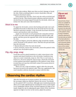 35
OBSERVING THE CARDIAC RHYTHM
Clip-on and
snap-on
leadwires
Several kinds of lead-
wires are available for
monitoring. A clip-on
leadwire should be at-
tached to the electrode
after it has been placed
on the patient’s chest.
A snap-on leadwire
should be attached to
the electrode just before
it has been placed on
the patient’s chest. Do-
ing so prevents patient
discomfort and distur-
bance of the contact
between the electrode
and the skin.
until the skin reddens. Make sure that you don't damage or break
the skin. Brisk scrubbing helps to remove dead skin cells and
improves electrical contact.
If the patient has oily skin, clean each site with an alcohol pad
and let it air-dry. This ensures proper adhesion and prevents the
alcohol from becoming trapped beneath the electrode, which can
irritate the skin and cause skin breakdown.
Stick it to me
To apply the electrodes, remove the backing and make sure each
pregelled electrode is still moist. If an electrode has become dry,
discard it and select another. A dry electrode decreases electrical
contact and interferes with waveforms.
Apply one electrode to each prepared site using this method:
Press one side of the electrode against the patient’s skin, pull
•
gently, and then press the opposite side of the electrode against
the skin.
Using two fingers, press the adhesive edge around the outside
•
of the electrode to the patient’s chest. This fixes the gel and stabi-
lizes the electrode.
Repeat this procedure for each electrode.
•
Every 24 hours, remove the electrodes, assess the patient’s skin,
•
and put new electrodes in place.
Clip, clip, snap, snap
You’ll also need to attach leadwires or cable connections to the
monitor and attach leadwires to the electrodes. Leadwires may
clip on or, more commonly, snap on. (See Clip-on and snap-on
leadwires.) If you’re using the snap-on type, attach the electrode
to the leadwire just before applying it to the patient’s chest. Keep
in mind that you may lose electrode contact if you press down to
apply the leadwire.
When you use a clip-on leadwire, apply it after the electrode
has been secured to the patient’s skin. That way, applying the clip
won’t interfere with the electrode’s contact with the skin.
Observing the cardiac rhythm
After the electrodes are in proper position, the monitor is on, and
the necessary cables are attached, observe the screen. You should
see the patient’s ECG waveform. Although some monitoring systems
allow you to make adjustments by touching the screen, most require
you to manipulate buttons. If the waveform appears too large or too
small, change the size by adjusting the gain control. If the waveform
appears too high or too low on the screen, adjust the position.
Clip-on leadwire
Snap-on leadwire
Leadwire
Electrode
Electrode
Leadwire
ECG_Chap02.indd 35
ECG_Chap02.indd 35 7/8/2010 4:17:01 PM
7/8/2010 4:17:01 PM
 