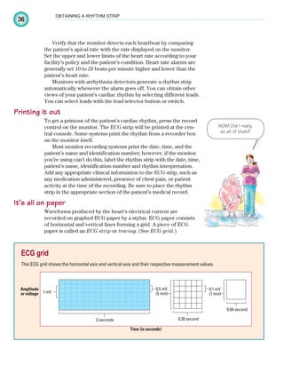36
OBTAINING A RHYTHM STRIP
Verify that the monitor detects each heartbeat by comparing
the patient’s apical rate with the rate displayed on the monitor.
Set the upper and lower limits of the heart rate according to your
facility’s policy and the patient’s condition. Heart rate alarms are
generally set 10 to 20 beats per minute higher and lower than the
patient’s heart rate.
Monitors with arrhythmia detectors generate a rhythm strip
automatically whenever the alarm goes off. You can obtain other
views of your patient’s cardiac rhythm by selecting different leads.
You can select leads with the lead selector button or switch.
Printing it out
To get a printout of the patient’s cardiac rhythm, press the record
control on the monitor. The ECG strip will be printed at the cen-
tral console. Some systems print the rhythm from a recorder box
on the monitor itself.
Most monitor recording systems print the date, time, and the
patient’s name and identification number; however, if the monitor
you’re using can’t do this, label the rhythm strip with the date, time,
patient’s name, identification number and rhythm interpretation.
Add any appropriate clinical information to the ECG strip, such as
any medication administered, presence of chest pain, or patient
activity at the time of the recording. Be sure to place the rhythm
strip in the appropriate section of the patient’s medical record.
It’s all on paper
Waveforms produced by the heart’s electrical current are
recorded on graphed ECG paper by a stylus. ECG paper consists
of horizontal and vertical lines forming a grid. A piece of ECG
paper is called an ECG strip or tracing. (See ECG grid.)
ECG grid
This ECG grid shows the horizontal axis and vertical axis and their respective measurement values.
1 mV
0.1 mV
(1 mm)
0.5 mV
(5 mm)
3 seconds 0.20 second
0.04 second
Time (in seconds)
Amplitude
or voltage
WOW! Did I really
do all of that?!
ECG_Chap02.indd 36
ECG_Chap02.indd 36 7/8/2010 4:17:02 PM
7/8/2010 4:17:02 PM
 