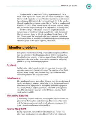 37
MONITOR PROBLEMS
The horizontal axis of the ECG strip represents time. Each
small block equals 0.04 second, and five small blocks form a large
block, which equals 0.2 second. This time increment is determined
by multiplying 0.04 second (for one small block) by 5, the number
of small blocks that compose a large block. Five large blocks equal
1 second (5 ✕ 0.2). When measuring or calculating a patient’s heart
rate, a 6-second strip consisting of 30 large blocks is usually used.
The ECG strip’s vertical axis measures amplitude in milli-
meters (mm) or electrical voltage in millivolts (mV). Each small
block represents 1 mm or 0.1 mV; each large block, 5 mm or 0.5
mV. To determine the amplitude of a wave, segment, or interval,
count the number of small blocks from the baseline to the highest
or lowest point of the wave, segment, or interval.
Monitor problems
For optimal cardiac monitoring, you need to recognize problems
that can interfere with obtaining a reliable ECG recording. (See
Troubleshooting monitor problems, pages 38 and 39.) Causes of
interference include artifact from patient movement and poorly
placed or poorly functioning equipment.
Artifact
Artifact, also called waveform interference, may be seen with
excessive movement (somatic tremor). The baseline of the ECG
appears wavy, bumpy, or tremulous. Dry electrodes may also
cause this problem due to poor contact.
Interference
Electrical interference, also called 60-cycle interference, is caused
by electrical power leakage. It may also occur due to interference
from other room equipment or improperly grounded equipment.
As a result, the lost current pulses at a rate of 60 cycles per sec-
ond. This interference appears on the ECG as a baseline that’s
thick and unreadable.
Wandering baseline
A wandering baseline undulates, meaning that all waveforms are
present but the baseline isn’t stationary. Movement of the chest
wall during respiration, poor electrode placement, or poor elec-
trode contact usually causes this problem.
Faulty equipment
Faulty equipment, such as broken leadwires and cables, can
also cause monitoring problems. Excessively worn equipment
ECG_Chap02.indd 37
ECG_Chap02.indd 37 7/8/2010 4:17:04 PM
7/8/2010 4:17:04 PM
 