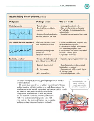 39
MONITOR PROBLEMS
can cause improper grounding, putting the patient at risk for
accidental shock.
Be aware that some types of artifact resemble arrhythmias,
and the monitor will interpret them as such. For example, the
monitor may sense a small movement, such as the patient brush-
ing his teeth, as a potentially lethal ventricular
tachycardia. So remember to treat the patient,
not the monitor. The more familiar you become
with your unit’s monitoring system—and with
your patient—the more quickly you can recognize
and interpret problems and act appropriately.
Troubleshooting monitor problems (continued)
What you see
Wandering baseline
Fuzzy baseline (electrical interference)
Baseline (no waveform)
What might cause it
• Patient restless
• Chest wall movement during
respiration
• Improper electrode application;
electrode positioned over bone
• Electrical interference from
other equipment in the room
• Improper grounding of the
patient’s bed
• Electrode malfunction
• Improper electrode placement
(perpendicular to axis of heart)
• Electrode disconnected
• Dry electrode gel
• Wire or cable failure
What to do about it
• Encourage the patient to relax.
• Make sure that tension on the cable
isn’t pulling the electrode away from the
patient’s body.
• Reposition improperly placed electrodes.
• Ensure that all electrical equipment is at-
tached to a common ground.
• Check all three-pronged plugs to make
sure none of the prongs are loose.
• Ensure that the bed ground is attached to
the room’s common ground.
• Replace the electrodes.
• Reposition improperly placed electrodes.
• Check if electrodes are disconnected.
Reapply them as necessary.
• Check electrode gel. If the gel is dry, ap-
ply new electrodes.
• Replace faulty wires or cables.
Worn equipment can
cause problems—
including a possible
shock for the patient.
ECG_Chap02.indd 39
ECG_Chap02.indd 39 7/8/2010 4:17:06 PM
7/8/2010 4:17:06 PM
 