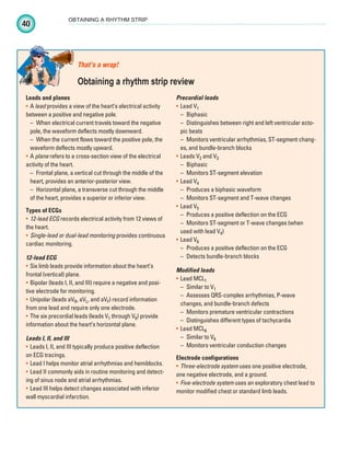 40
OBTAINING A RHYTHM STRIP
Leads and planes
A
• lead provides a view of the heart’s electrical activity
between a positive and negative pole.
– When electrical current travels toward the negative
pole, the waveform deflects mostly downward.
– When the current flows toward the positive pole, the
waveform deflects mostly upward.
A
• plane refers to a cross-section view of the electrical
activity of the heart.
– Frontal plane, a vertical cut through the middle of the
heart, provides an anterior-posterior view.
– Horizontal plane, a transverse cut through the middle
of the heart, provides a superior or inferior view.
Types of ECGs
12-lead ECG
• records electrical activity from 12 views of
the heart.
Single-lead or dual-lead monitoring
• provides continuous
cardiac monitoring.
12-lead ECG
Six limb leads provide information about the heart’s
•
frontal (vertical) plane.
Bipolar (leads I, II, and III) require a negative and posi-
•
tive electrode for monitoring.
Unipolar (leads aV
• R, aVL, and aVF) record information
from one lead and require only one electrode.
The six precordial leads (leads V
• 1 through V6) provide
information about the heart’s horizontal plane.
Leads I, II, and III
Leads I, II, and III typically produce positive deflection
•
on ECG tracings.
Lead I helps monitor atrial arrhythmias and hemiblocks.
•
Lead II commonly aids in routine monitoring and detect-
•
ing of sinus node and atrial arrhythmias.
Lead III helps detect changes associated with inferior
•
wall myocardial infarction.
Precordial leads
Lead V
• 1
– Biphasic
– Distinguishes between right and left ventricular ecto-
pic beats
– Monitors ventricular arrhythmias, ST-segment chang-
es, and bundle-branch blocks
Leads V
• 2 and V3
– Biphasic
– Monitors ST-segment elevation
Lead V
• 4
– Produces a biphasic waveform
– Monitors ST-segment and T-wave changes
Lead V
• 5
– Produces a positive deflection on the ECG
– Monitors ST-segment or T-wave changes (when
used with lead V4)
Lead V
• 6
– Produces a positive deflection on the ECG
– Detects bundle-branch blocks
Modified leads
Lead MCL
• 1
– Similar to V1
– Assesses QRS-complex arrhythmias, P-wave
changes, and bundle-branch defects
– Monitors premature ventricular contractions
– Distinguishes different types of tachycardia
Lead MCL
• 6
– Similar to V6
– Monitors ventricular conduction changes
Electrode configurations
Three-electrode system
• uses one positive electrode,
one negative electrode, and a ground.
Five-electrode system
• uses an exploratory chest lead to
monitor modified chest or standard limb leads.
That’s a wrap!
Obtaining a rhythm strip review
ECG_Chap02.indd 40
ECG_Chap02.indd 40 7/8/2010 4:17:11 PM
7/8/2010 4:17:11 PM
 