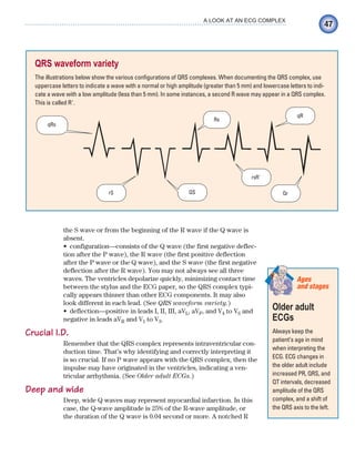 47
A LOOK AT AN ECG COMPLEX
the S wave or from the beginning of the R wave if the Q wave is
absent.
configuration—consists of the Q wave (the first negative deflec-
•
tion after the P wave), the R wave (the first positive deflection
after the P wave or the Q wave), and the S wave (the first negative
deflection after the R wave). You may not always see all three
waves. The ventricles depolarize quickly, minimizing contact time
between the stylus and the ECG paper, so the QRS complex typi-
cally appears thinner than other ECG components. It may also
look different in each lead. (See QRS waveform variety.)
deflection—positive in leads I, II, III, aV
• L, aVF, and V4 to V6 and
negative in leads aVR and V1 to V3.
Crucial I.D.
Remember that the QRS complex represents intraventricular con-
duction time. That’s why identifying and correctly interpreting it
is so crucial. If no P wave appears with the QRS complex, then the
impulse may have originated in the ventricles, indicating a ven-
tricular arrhythmia. (See Older adult ECGs.)
Deep and wide
Deep, wide Q waves may represent myocardial infarction. In this
case, the Q-wave amplitude is 25% of the R-wave amplitude, or
the duration of the Q wave is 0.04 second or more. A notched R
QRS waveform variety
The illustrations below show the various configurations of QRS complexes. When documenting the QRS complex, use
uppercase letters to indicate a wave with a normal or high amplitude (greater than 5 mm) and lowercase letters to indi-
cate a wave with a low amplitude (less than 5 mm). In some instances, a second R wave may appear in a QRS complex.
This is called R⬘.
rS Qr
qRs
QS
Rs
rsR´
qR
Older adult
ECGs
Always keep the
patient’s age in mind
when interpreting the
ECG. ECG changes in
the older adult include
increased PR, QRS, and
QT intervals, decreased
amplitude of the QRS
complex, and a shift of
the QRS axis to the left.
Ages
and stages
ECG_Chap03.indd 47
ECG_Chap03.indd 47 7/7/2010 5:51:00 PM
7/7/2010 5:51:00 PM
 