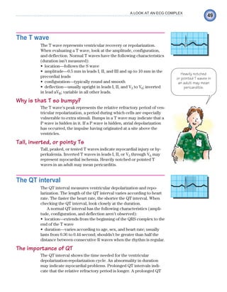 49
A LOOK AT AN ECG COMPLEX
The T wave
The T wave represents ventricular recovery or repolarization.
When evaluating a T wave, look at the amplitude, configuration,
and deflection. Normal T waves have the following characteristics
(duration isn’t measured):
location—follows the S wave
•
amplitude—0.5 mm in leads I, II, and III and up to 10 mm in the
•
precordial leads
configuration—typically round and smooth
•
deflection—usually upright in leads I, II, and V
• 3 to V6; inverted
in lead aVR; variable in all other leads.
Why is that T so bumpy?
The T wave’s peak represents the relative refractory period of ven-
tricular repolarization, a period during which cells are especially
vulnerable to extra stimuli. Bumps in a T wave may indicate that a
P wave is hidden in it. If a P wave is hidden, atrial depolarization
has occurred, the impulse having originated at a site above the
ventricles.
Tall, inverted, or pointy Ts
Tall, peaked, or tented T waves indicate myocardial injury or hy-
perkalemia. Inverted T waves in leads I, II, or V3 through V6 may
represent myocardial ischemia. Heavily notched or pointed T
waves in an adult may mean pericarditis.
The QT interval
The QT interval measures ventricular depolarization and repo-
larization. The length of the QT interval varies according to heart
rate. The faster the heart rate, the shorter the QT interval. When
checking the QT interval, look closely at the duration.
A normal QT interval has the following characteristics (ampli-
tude, configuration, and deflection aren’t observed):
location—extends from the beginning of the QRS complex to the
•
end of the T wave
duration—varies according to age, sex, and heart rate; usually
•
lasts from 0.36 to 0.44 second; shouldn’t be greater than half the
distance between consecutive R waves when the rhythm is regular.
The importance of QT
The QT interval shows the time needed for the ventricular
depolarization-repolarization cycle. An abnormality in duration
may indicate myocardial problems. Prolonged QT intervals indi-
cate that the relative refractory period is longer. A prolonged QT
Heavily notched
or pointed T waves in
an adult may mean
pericarditis.
ECG_Chap03.indd 49
ECG_Chap03.indd 49 7/7/2010 5:51:01 PM
7/7/2010 5:51:01 PM
 