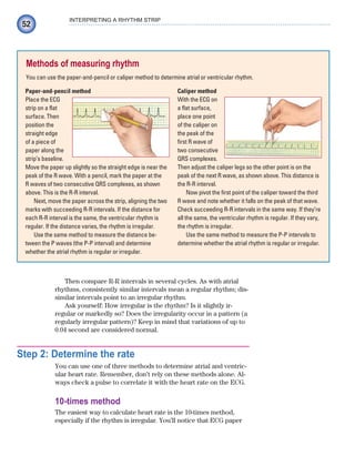 52
INTERPRETING A RHYTHM STRIP
Then compare R-R intervals in several cycles. As with atrial
rhythms, consistently similar intervals mean a regular rhythm; dis-
similar intervals point to an irregular rhythm.
Ask yourself: How irregular is the rhythm? Is it slightly ir-
regular or markedly so? Does the irregularity occur in a pattern (a
regularly irregular pattern)? Keep in mind that variations of up to
0.04 second are considered normal.
Step 2: Determine the rate
You can use one of three methods to determine atrial and ventric-
ular heart rate. Remember, don’t rely on these methods alone. Al-
ways check a pulse to correlate it with the heart rate on the ECG.
10-times method
The easiest way to calculate heart rate is the 10-times method,
especially if the rhythm is irregular. You’ll notice that ECG paper
Methods of measuring rhythm
You can use the paper-and-pencil or caliper method to determine atrial or ventricular rhythm.
Paper-and-pencil method
Place the ECG
strip on a flat
surface. Then
position the
straight edge
of a piece of
paper along the
strip’s baseline.
Move the paper up slightly so the straight edge is near the
peak of the R wave. With a pencil, mark the paper at the
R waves of two consecutive QRS complexes, as shown
above. This is the R-R interval.
Next, move the paper across the strip, aligning the two
marks with succeeding R-R intervals. If the distance for
each R-R interval is the same, the ventricular rhythm is
regular. If the distance varies, the rhythm is irregular.
Use the same method to measure the distance be-
tween the P waves (the P-P interval) and determine
whether the atrial rhythm is regular or irregular.
Caliper method
With the ECG on
a flat surface,
place one point
of the caliper on
the peak of the
first R wave of
two consecutive
QRS complexes.
Then adjust the caliper legs so the other point is on the
peak of the next R wave, as shown above. This distance is
the R-R interval.
Now pivot the first point of the caliper toward the third
R wave and note whether it falls on the peak of that wave.
Check succeeding R-R intervals in the same way. If they’re
all the same, the ventricular rhythm is regular. If they vary,
the rhythm is irregular.
Use the same method to measure the P-P intervals to
determine whether the atrial rhythm is regular or irregular.
ECG_Chap03.indd 52
ECG_Chap03.indd 52 7/7/2010 5:51:03 PM
7/7/2010 5:51:03 PM
 