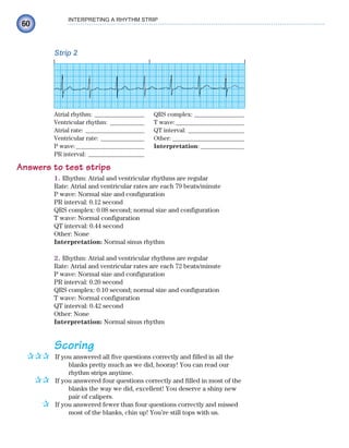 60
INTERPRETING A RHYTHM STRIP
Strip 2
Atrial rhythm: ________________ QRS complex: ________________
Ventricular rhythm: ___________ T wave:______________________
Atrial rate: ___________________ QT interval: __________________
Ventricular rate: ______________ Other: _______________________
P wave:______________________ Interpretation: ______________
PR interval: __________________
Answers to test strips
1. Rhythm: Atrial and ventricular rhythms are regular
Rate: Atrial and ventricular rates are each 79 beats/minute
P wave: Normal size and configuration
PR interval: 0.12 second
QRS complex: 0.08 second; normal size and configuration
T wave: Normal configuration
QT interval: 0.44 second
Other: None
Interpretation: Normal sinus rhythm
2. Rhythm: Atrial and ventricular rhythms are regular
Rate: Atrial and ventricular rates are each 72 beats/minute
P wave: Normal size and configuration
PR interval: 0.20 second
QRS complex: 0.10 second; normal size and configuration
T wave: Normal configuration
QT interval: 0.42 second
Other: None
Interpretation: Normal sinus rhythm
Scoring
If you answered all five questions correctly and filled in all the
blanks pretty much as we did, hooray! You can read our
rhythm strips anytime.
If you answered four questions correctly and filled in most of the
blanks the way we did, excellent! You deserve a shiny new
pair of calipers.
If you answered fewer than four questions correctly and missed
most of the blanks, chin up! You’re still tops with us.
✰✰✰
✰✰
✰
ECG_Chap03.indd 60
ECG_Chap03.indd 60 7/7/2010 5:51:07 PM
7/7/2010 5:51:07 PM
 