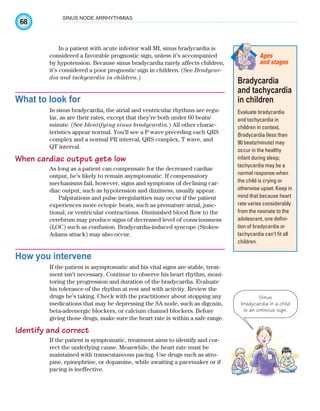 68
SINUS NODE ARRHYTHMIAS
In a patient with acute inferior wall MI, sinus bradycardia is
considered a favorable prognostic sign, unless it’s accompanied
by hypotension. Because sinus bradycardia rarely affects children,
it’s considered a poor prognostic sign in children. (See Bradycar-
dia and tachycardia in children.)
What to look for
In sinus bradycardia, the atrial and ventricular rhythms are regu-
lar, as are their rates, except that they’re both under 60 beats/
minute. (See Identifying sinus bradycardia.) All other charac-
teristics appear normal. You’ll see a P wave preceding each QRS
complex and a normal PR interval, QRS complex, T wave, and
QT interval.
When cardiac output gets low
As long as a patient can compensate for the decreased cardiac
output, he’s likely to remain asymptomatic. If compensatory
mechanisms fail, however, signs and symptoms of declining car-
diac output, such as hypotension and dizziness, usually appear.
Palpitations and pulse irregularities may occur if the patient
experiences more ectopic beats, such as premature atrial, junc-
tional, or ventricular contractions. Diminished blood flow to the
cerebrum may produce signs of decreased level of consciousness
(LOC) such as confusion. Bradycardia-induced syncope (Stokes-
Adams attack) may also occur.
How you intervene
If the patient is asymptomatic and his vital signs are stable, treat-
ment isn’t necessary. Continue to observe his heart rhythm, moni-
toring the progression and duration of the bradycardia. Evaluate
his tolerance of the rhythm at rest and with activity. Review the
drugs he’s taking. Check with the practitioner about stopping any
medications that may be depressing the SA node, such as digoxin,
beta-adrenergic blockers, or calcium channel blockers. Before
giving those drugs, make sure the heart rate is within a safe range.
Identify and correct
If the patient is symptomatic, treatment aims to identify and cor-
rect the underlying cause. Meanwhile, the heart rate must be
maintained with transcutaneous pacing. Use drugs such as atro-
pine, epinephrine, or dopamine, while awaiting a pacemaker or if
pacing is ineffective.
Bradycardia
and tachycardia
in children
Evaluate bradycardia
and tachycardia in
children in context.
Bradycardia (less than
90 beats/minute) may
occur in the healthy
infant during sleep;
tachycardia may be a
normal response when
the child is crying or
otherwise upset. Keep in
mind that because heart
rate varies considerably
from the neonate to the
adolescent, one defini-
tion of bradycardia or
tachycardia can’t fit all
children.
Ages
and stages
Sinus
bradycardia in a child
is an ominous sign.
ECG_Chap04.indd 68
ECG_Chap04.indd 68 7/8/2010 9:30:09 AM
7/8/2010 9:30:09 AM
 