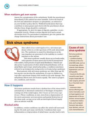 78
SINUS NODE ARRHYTHMIAS
When matters get even worse
Assess for a progression of the arrhythmia. Notify the practitioner
immediately if the patient becomes unstable. Lower the head of
the bed and administer atropine or epinephrine, as ordered or
as your facility’s policy directs. Withhold medications that may
contribute to sinus pauses and check with the practitioner about
whether those drugs should be continued.
If appropriate, be alert for signs of digoxin, quinidine, or pro-
cainamide toxicity. Obtain a serum digoxin level and a serum
electrolyte level. If a pacemaker is implanted, give the patient dis-
charge instructions about pacemaker care.
Sick sinus syndrome
Also called sinus nodal dysfunction, sick sinus syn-
drome refers to a wide spectrum of SA node abnormali-
ties. The syndrome is caused by disturbances in the
way impulses are generated or the inability to conduct
impulses to the atrium.
Sick sinus syndrome usually shows up as bradycardia,
with episodes of sinus arrest and SA block interspersed
with sudden, brief periods of rapid atrial fibrillation. Patients are
also prone to paroxysms of other atrial tachyarrhythmias, such as
atrial flutter and ectopic atrial tachycardia, a condition sometimes
referred to as bradycardia-tachycardia (or brady-tachy) syndrome.
Most patients with sick sinus syndrome are older than age 60,
but anyone can develop the arrhythmia. It’s rare in children ex-
cept after open-heart surgery that results in SA node damage. The
arrhythmia affects men and women equally. The onset is progres-
sive, insidious, and chronic.
How it happens
Sick sinus syndrome results from a dysfunction of the sinus node’s
automaticity or abnormal conduction or blockages of impulses
coming out of the nodal region. (See Causes of sick sinus syn-
drome.) These conditions, in turn, stem from a degeneration of
the area’s autonomic nervous system and partial destruction of
the sinus node, as may occur with an interrupted blood supply
after an inferior wall MI.
Blocked exits
In addition, certain conditions can affect the atrial wall surround-
ing the SA node and cause exit blocks. Conditions that cause
inflammation or degeneration of atrial tissue can also lead to sick
Causes of sick
sinus syndrome
Sick sinus syndrome
may result from:
conditions leading
•
to fibrosis of the sino-
atrial (SA) node, such as
increased age, athero-
sclerotic heart disease,
hypertension, and car-
diomyopathy
trauma to the SA node
•
caused by open heart
surgery (especially val-
vular surgery), pericardi-
tis, or rheumatic heart
disease
autonomic distur-
•
bances affecting auto-
nomic innervation, such
as hypervagatonia and
degeneration of the au-
tonomic nervous system
cardioactive medica-
•
tions, such as digoxin
(Lanoxin), beta-adren-
ergic blockers, and cal-
cium channel blockers.
ECG_Chap04.indd 78
ECG_Chap04.indd 78 7/8/2010 9:30:16 AM
7/8/2010 9:30:16 AM
 