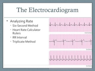 Ekg intro | PPT