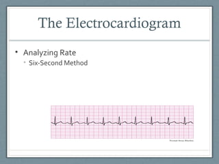 Ekg intro | PPT