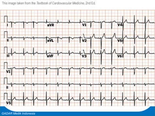 Basic Cardiac Life Support
GADAR Medik Indonesia
 