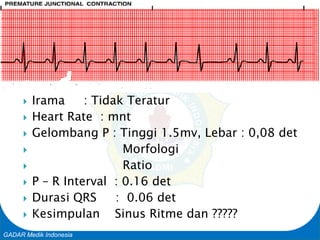 Basic Cardiac Life Support
GADAR Medik Indonesia
 Irama : Tidak Teratur
 Heart Rate : mnt
 Gelombang P : Tinggi 1.5mv, Lebar : 0,08 det
 Morfologi
 Ratio
 P – R Interval : 0.16 det
 Durasi QRS : 0.06 det
 Kesimpulan Sinus Ritme dan ?????
 