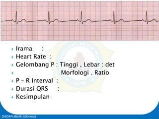 Basic Cardiac Life Support
GADAR Medik Indonesia
 Irama :
 Heart Rate :
 Gelombang P : Tinggi , Lebar : det
 Morfologi . Ratio
 P – R Interval :
 Durasi QRS :
 Kesimpulan
 