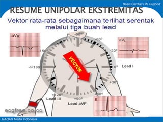 Basic Cardiac Life Support
GADAR Medik Indonesia
RESUME UNIPOLAR EKSTREMITAS
 