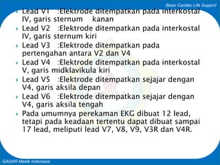 Basic Cardiac Life Support
GADAR Medik Indonesia
 Lead V1 :Elektrode ditempatkan pada interkostal
IV, garis sternum kanan
 Lead V2 :Elektrode ditempatkan pada interkostal
IV, garis sternum kiri
 Lead V3 :Elektrode ditempatkan pada
pertengahan antara V2 dan V4
 Lead V4 :Elektrode ditempatkan pada interkostal
V, garis midklavikula kiri
 Lead V5 :Elektrode ditempatkan sejajar dengan
V4, garis aksila depan
 Lead V6 :Elektrode ditempatkan sejajar dengan
V4, garis aksila tengah
 Pada umumnya perekaman EKG dibuat 12 lead,
tetapi pada keadaan tertentu dapat dibuat sampai
17 lead, meliputi lead V7, V8, V9, V3R dan V4R.
 