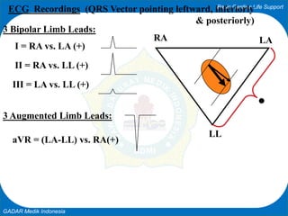 Basic Cardiac Life Support
GADAR Medik Indonesia
LARA
LL
ECG Recordings (QRS Vector pointing leftward, inferiorly
& posteriorly)
3 Bipolar Limb Leads:
I = RA vs. LA (+)
II = RA vs. LL (+)
III = LA vs. LL (+)
3 Augmented Limb Leads:
aVR = (LA-LL) vs. RA(+)
 