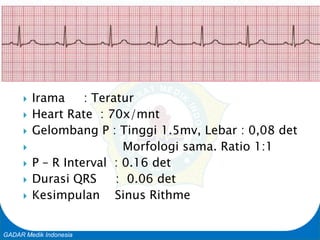 Basic Cardiac Life Support
GADAR Medik Indonesia
 Irama : Teratur
 Heart Rate : 70x/mnt
 Gelombang P : Tinggi 1.5mv, Lebar : 0,08 det
 Morfologi sama. Ratio 1:1
 P – R Interval : 0.16 det
 Durasi QRS : 0.06 det
 Kesimpulan Sinus Rithme
 