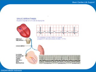Basic Cardiac Life Support
GADAR Medik Indonesia
 