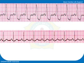 Basic Cardiac Life Support
GADAR Medik Indonesia
 