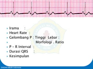 Basic Cardiac Life Support
GADAR Medik Indonesia
 Irama :
 Heart Rate :
 Gelombang P : Tinggi Lebar :
 Morfologi . Ratio
 P – R Interval :
 Durasi QRS :
 Kesimpulan
 