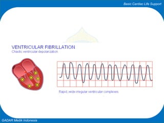 Basic Cardiac Life Support
GADAR Medik Indonesia
 