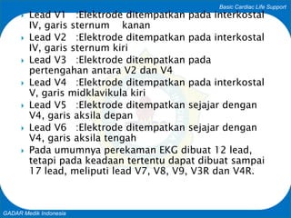 Basic Cardiac Life Support
GADAR Medik Indonesia
 Lead V1 :Elektrode ditempatkan pada interkostal
IV, garis sternum kanan...
