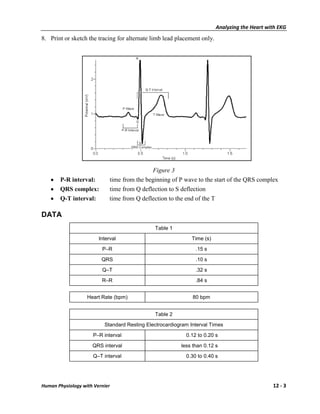 Analyzing the Heart with EKG
8. Print or sketch the tracing for alternate limb lead placement only.




                                             Figure 3
       P-R interval:         time from the beginning of P wave to the start of the QRS complex
       QRS complex:          time from Q deflection to S deflection
       Q-T interval:         time from Q deflection to the end of the T

DATA
                                              Table 1

                        Interval                              Time (s)

                         P–R                                   .15 s

                         QRS                                   .10 s
                         Q–T                                   .32 s

                         R–R                                   .84 s


                   Heart Rate (bpm)                           80 bpm


                                              Table 2

                          Standard Resting Electrocardiogram Interval Times

                     P–R interval                          0.12 to 0.20 s

                     QRS interval                        less than 0.12 s

                     Q–T interval                          0.30 to 0.40 s




Human Physiology with Vernier                                                                  12 - 3
 