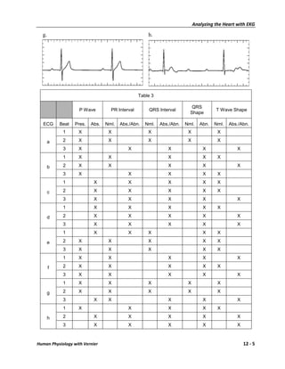 Analyzing the Heart with EKG

  g.                                                 h.




                                                 Table 3

                                                                          QRS
                    P Wave         PR Interval       QRS Interval                     T Wave Shape
                                                                         Shape

   ECG     Beat   Pres.   Abs.   Nml.   Abs./Abn.   Nml.   Abs./Abn.   Nml.    Abn.   Nml.   Abs./Abn.
            1      X              X                  X                  X              X

       a    2      X              X                  X                  X              X
            3      X                       X                  X                 X               X
            1      X              X                           X                 X      X

       b    2      X              X                           X                 X               X
            3      X                       X                  X                 X      X
            1              X               X                  X                 X      X

       c    2              X               X                  X                 X      X
            3              X               X                  X                 X               X
            1              X               X                  X                 X      X

       d    2              X               X                  X                 X               X
            3              X               X                  X                 X               X
            1              X               X         X                          X      X

       e    2      X              X                  X                          X      X
            3      X              X                  X                          X      X
            1      X              X                           X                 X               X

       f    2      X              X                           X                 X      X
            3      X              X                           X                 X               X
            1      X              X                  X                  X              X

       g    2      X              X                  X                  X              X
            3              X      X                           X                 X               X
            1      X                       X                  X                 X      X

       h    2              X               X                  X                 X               X
            3              X               X                  X                 X               X



Human Physiology with Vernier                                                                       12 - 5
 