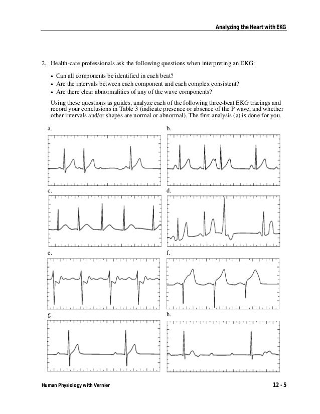 Ekg lab exp 3