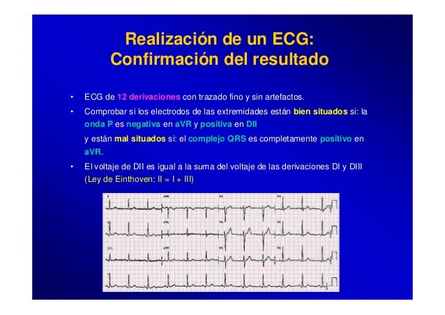 Como saber si un electrocardiograma esta mal tomado