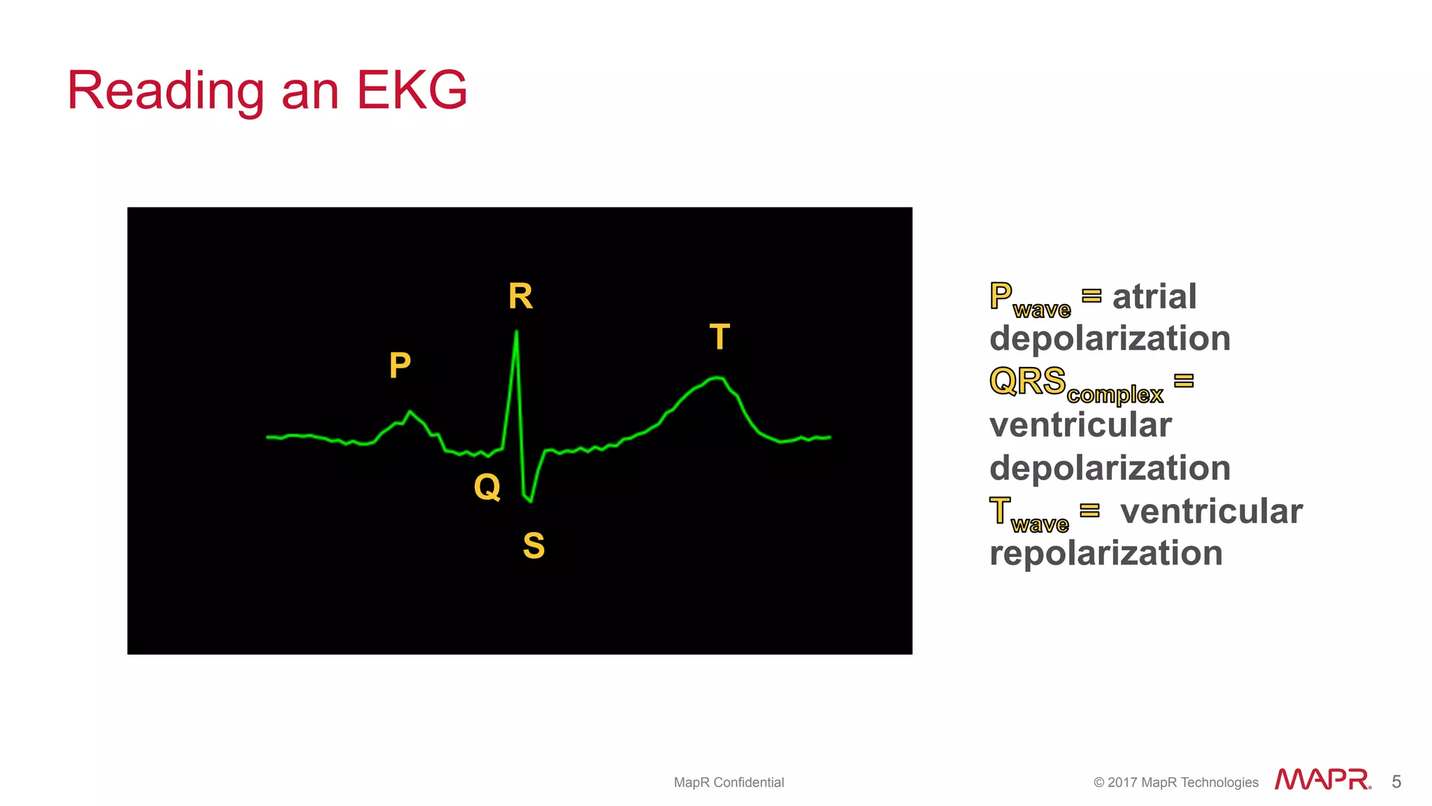 ®
© 2017 MapR Technologies 5® 5MapR Confidential
Reading an EKG
P
Q
R
S
T
atrial
depolarization
ventricular
depolarization
ventricular
repolarization
 