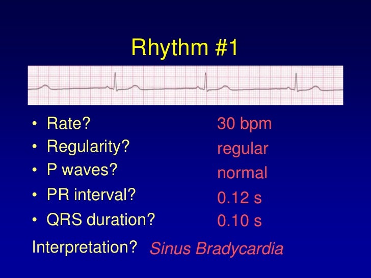 Ekg Module 4a
