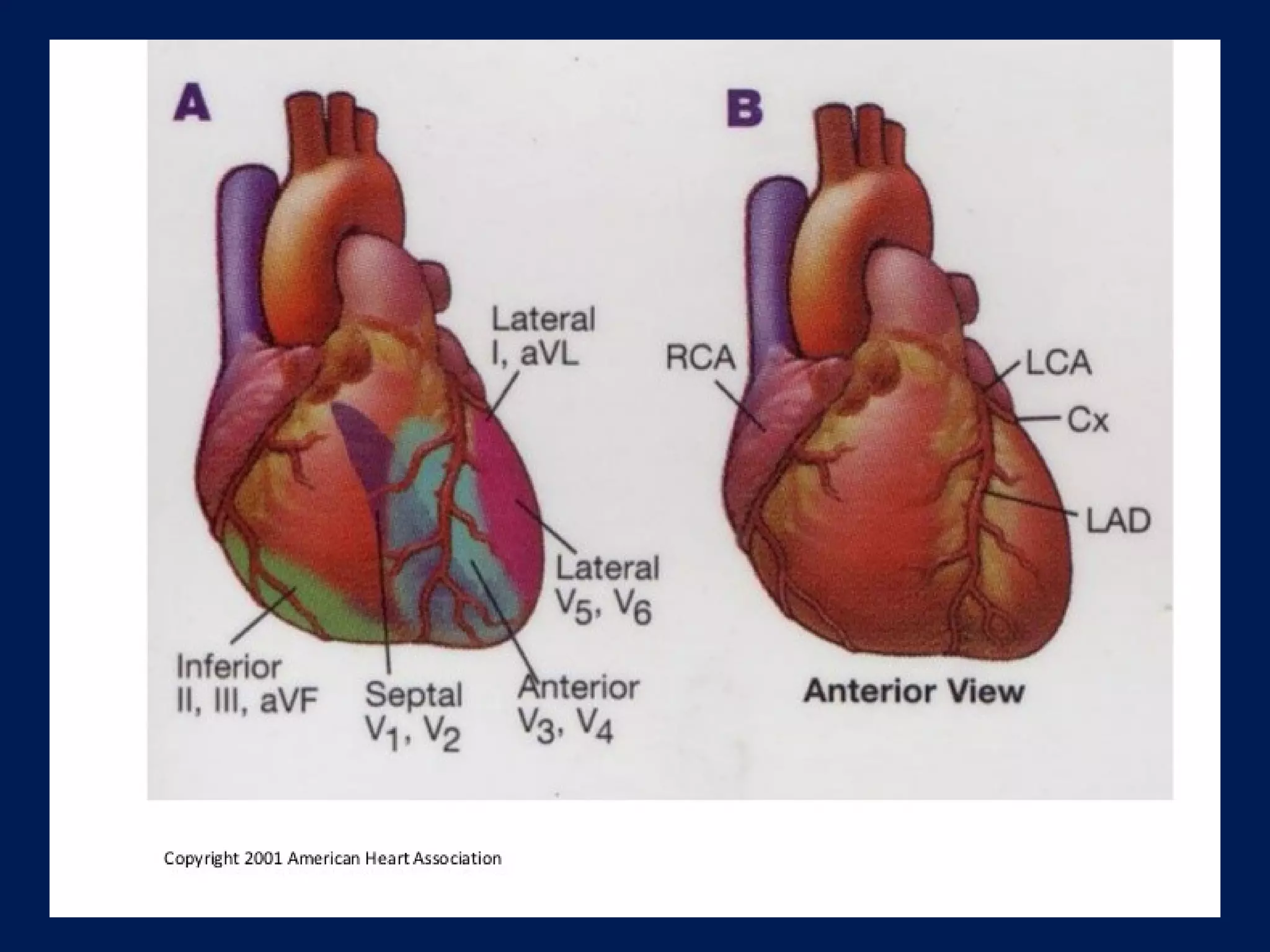 Ekg myocardial ischemia & Infarction | PPT | Free Download