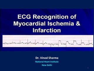 Ekg myocardial ischemia & Infarction | PPT
