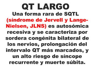 Se suele registrar mejor en V3 y V4 y con frecuencias cardiacas bajas.