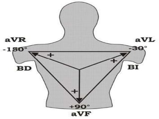 DERIVACIONES BIPOLARES DI-DII-DIII