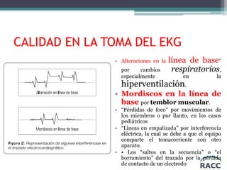 RACC
CALIDAD EN LA TOMA DEL EKG
• Alteraciones en la línea de base”
por cambios respiratorios,
especialmente en la
hiperventilación.
• Mordiscos en la línea de
base por temblor muscular.
• “Pérdidas de foco” por movimientos de
los miembros o por llanto, en los casos
pediátricos
• “Líneas en empalizada” por interferencia
eléctrica, la cual se debe a que el equipo
comparte el tomacorriente con otro
aparato.
• • Los “saltos en la secuencia” o “el
borramiento” del trazado por la pérdida
de contacto de un electrodo
 